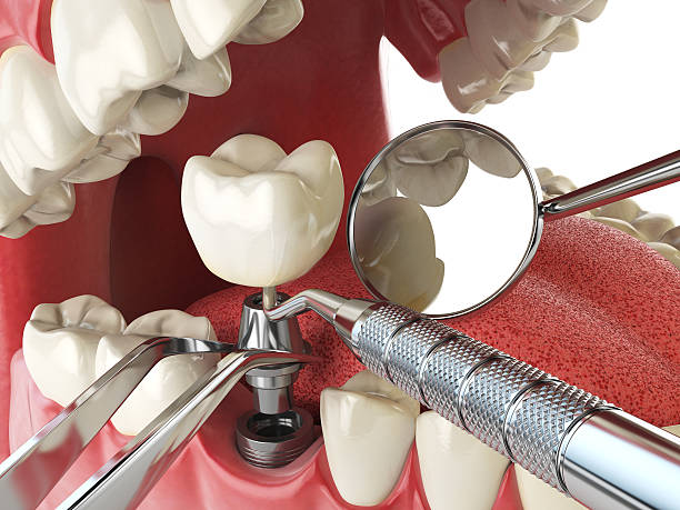 Best Emergency Gum Treatment in Douglas, GA